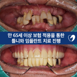 발곡역치과