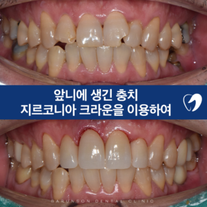 의정부치과