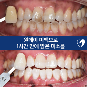 의정부치과