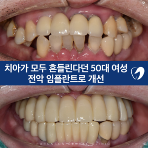 의정부치과