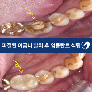 의정부치과
