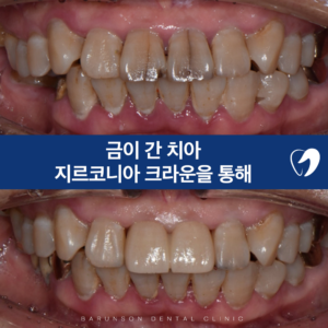 신곡동치과