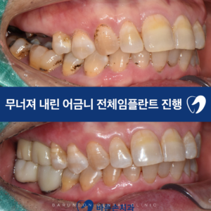 신곡동치과