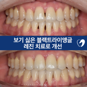 신곡동치과