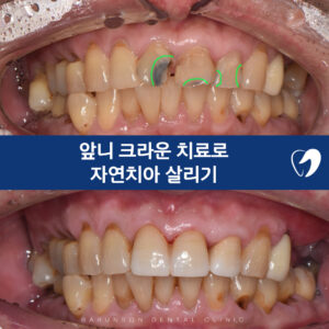 크라운대표이미지