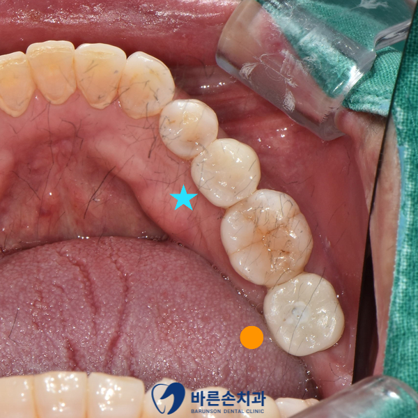 신곡동치과