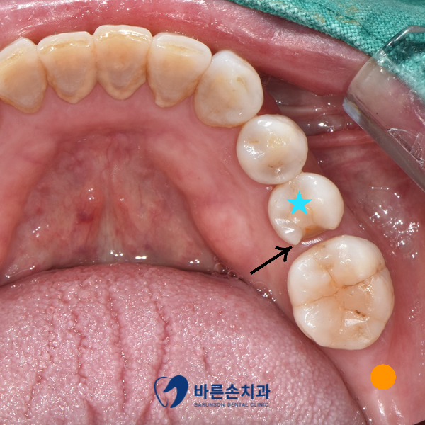 신곡동치과