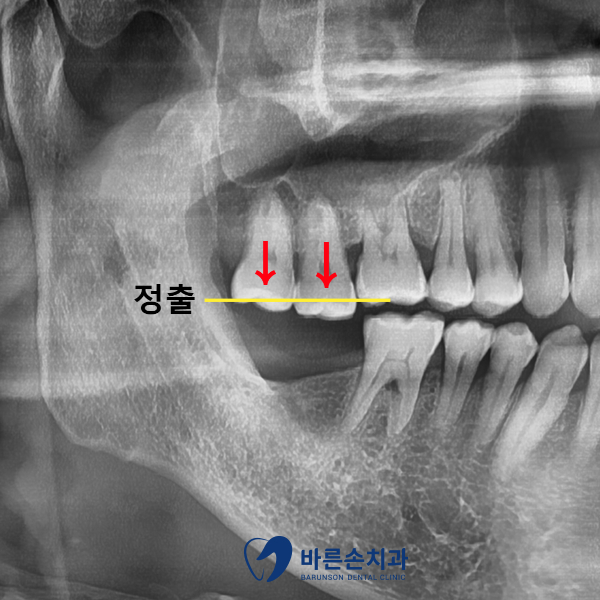 신곡동치과