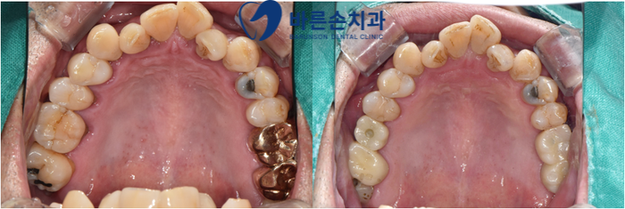 신곡동치과