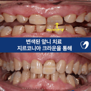 신곡동치과