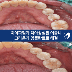 신곡동치과