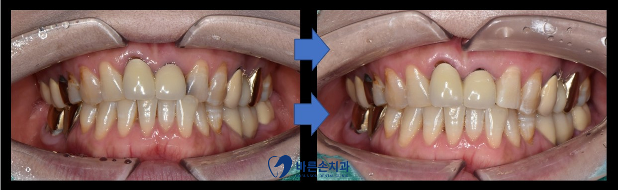 발곡역치과