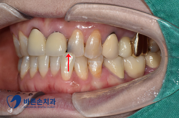 발곡역치과