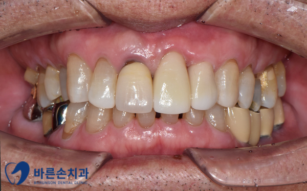 발골역치과