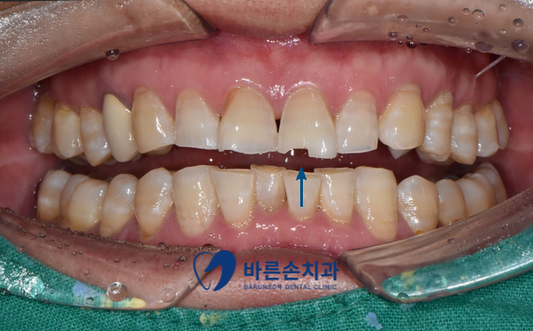 신곡동치과