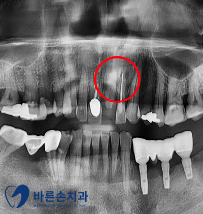 발골역치과