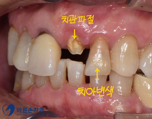 발골역치과