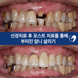 발골역치과