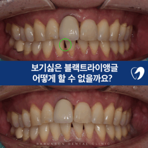 신곡동치과