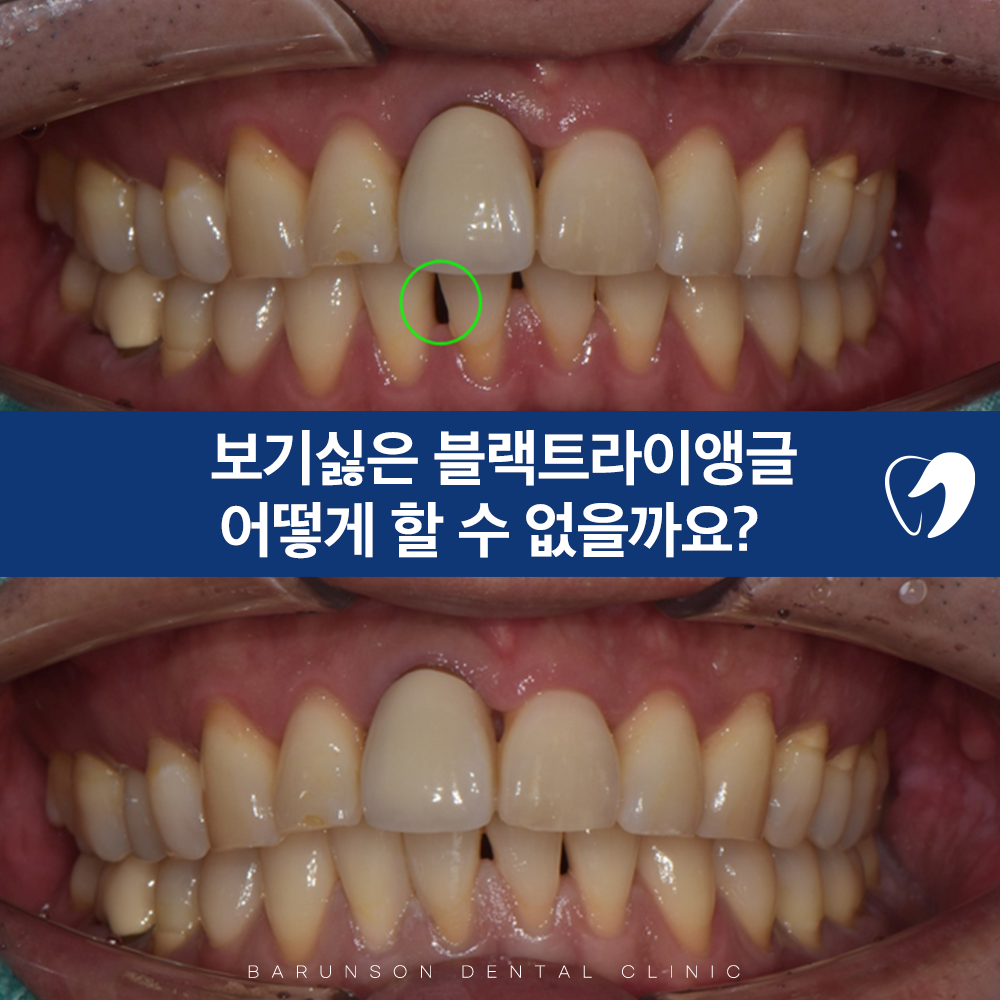 신곡동치과