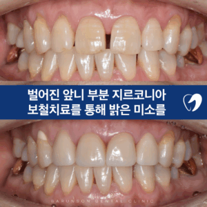 신곡동치과