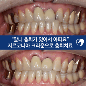 발곡역치과