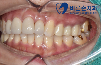 의정부치과