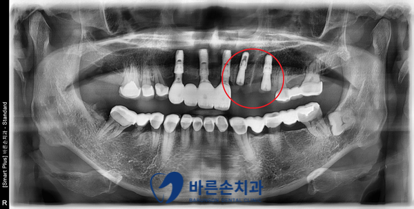 신곡동치과