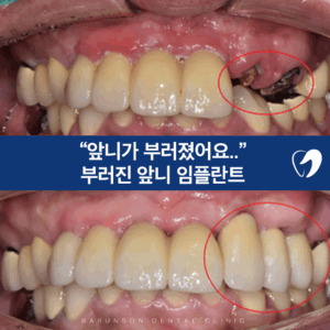 신곡동치과