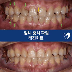 의정부치과