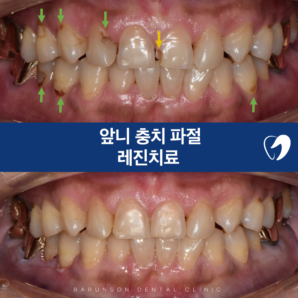 의정부치과