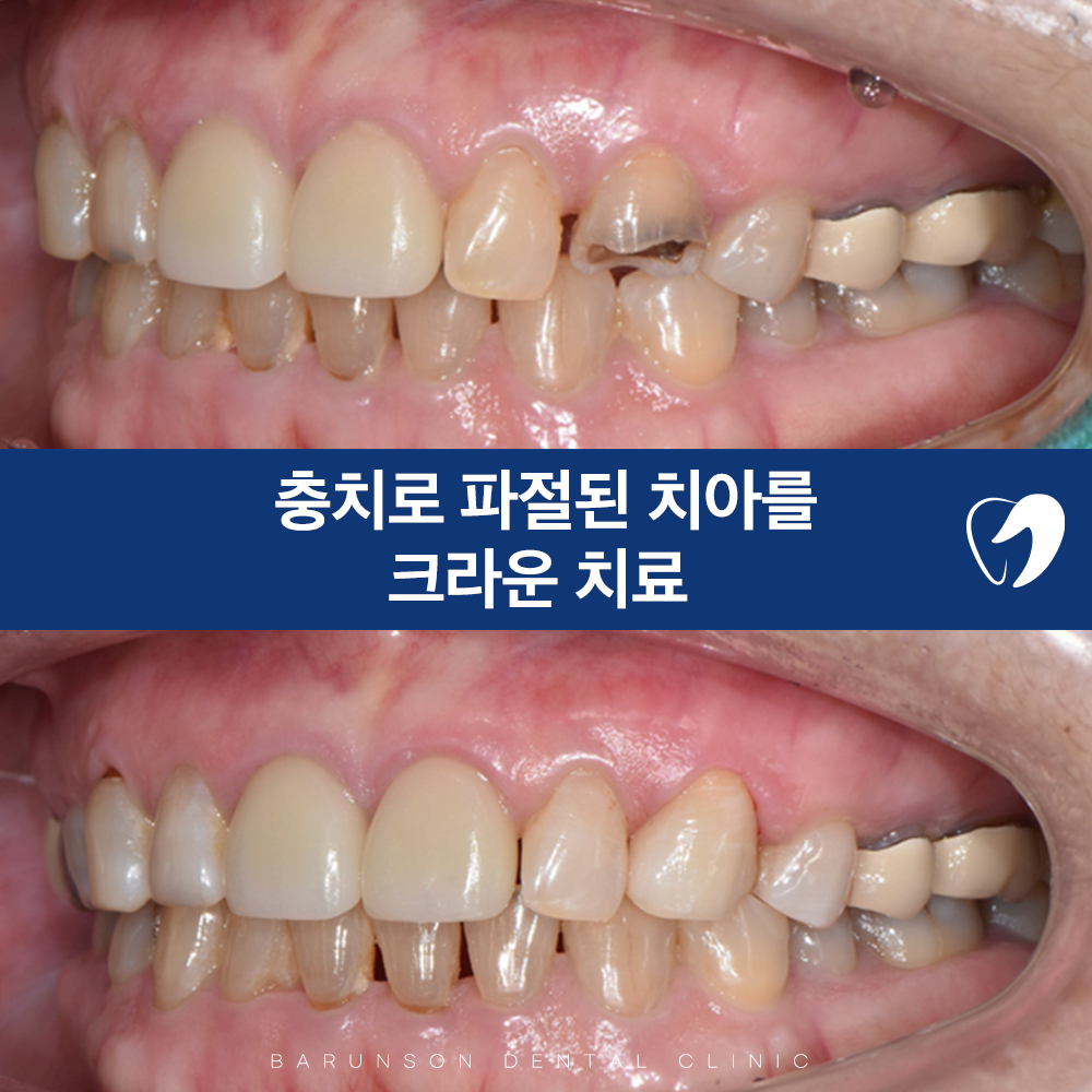 신곡동치과