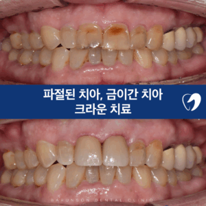 신곡동치과
