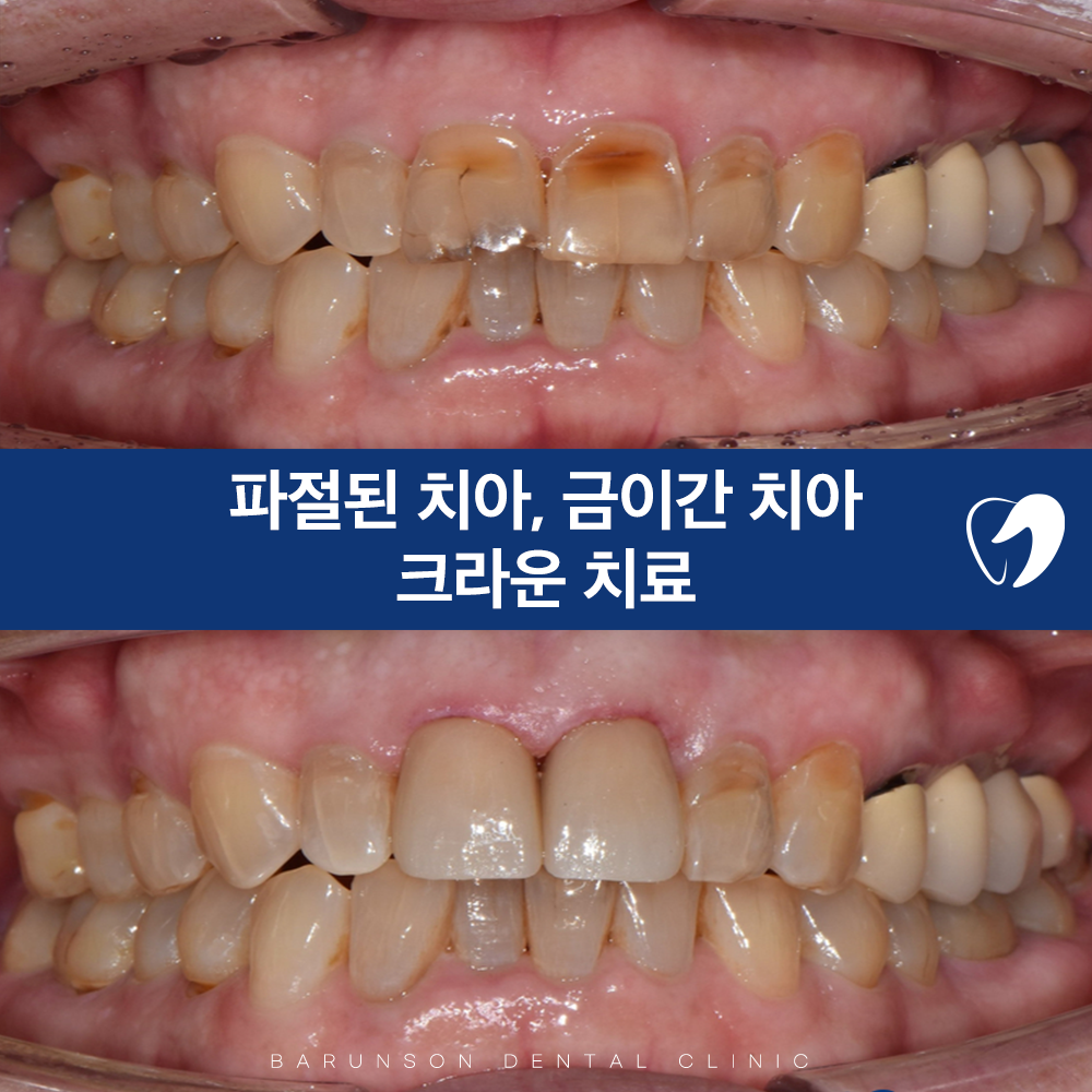 신곡동치과