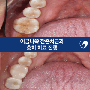 신곡동임플란트