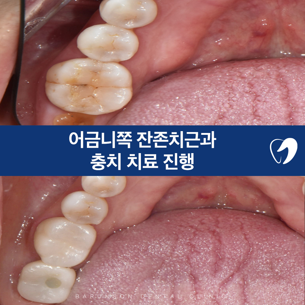 신곡동임플란트