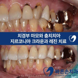발곡역치과