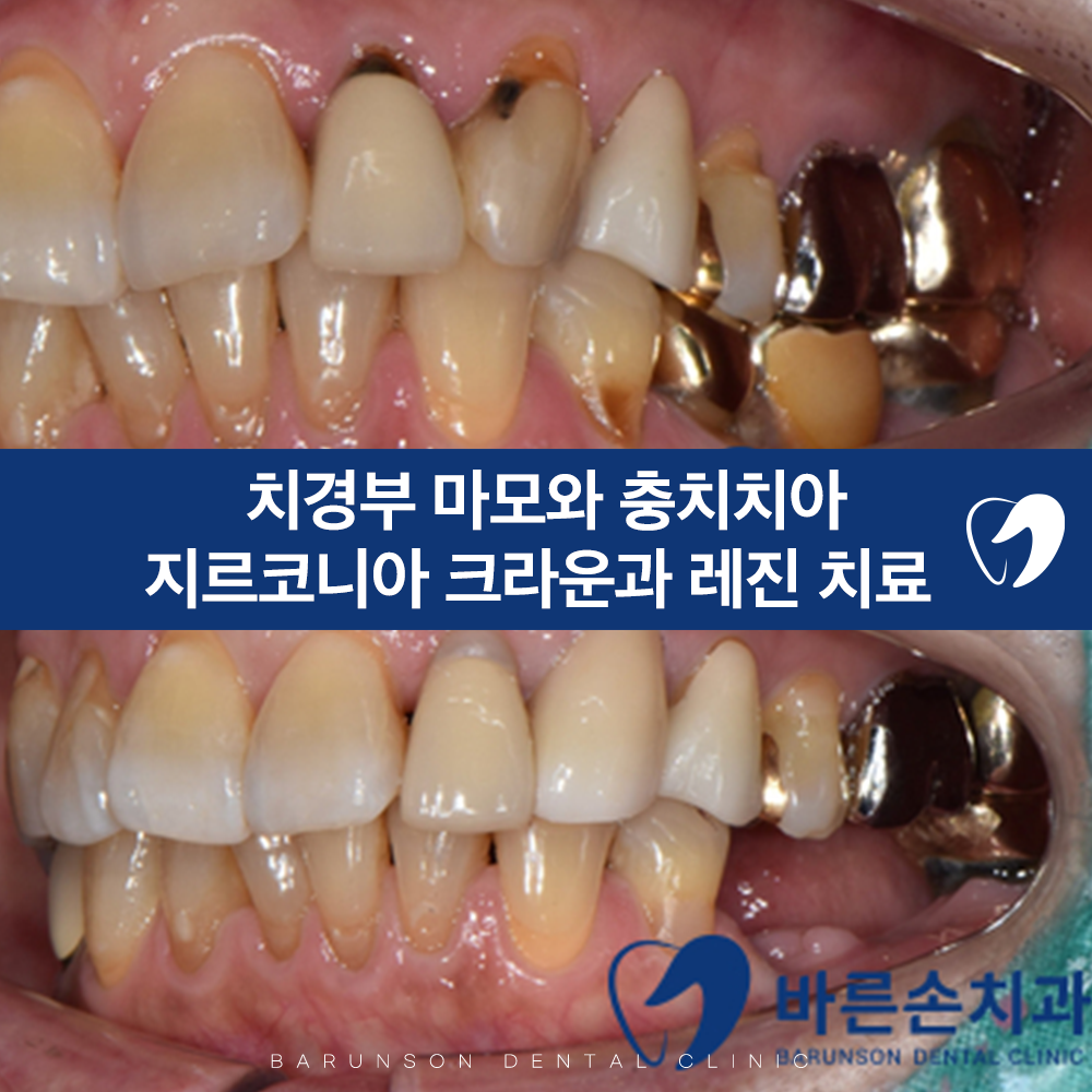 발곡역치과