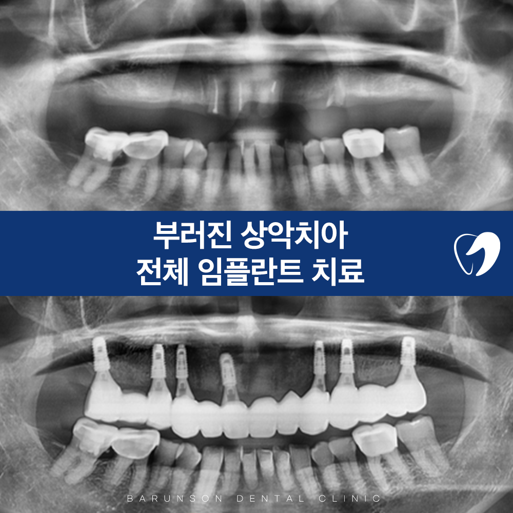 발곡동치과