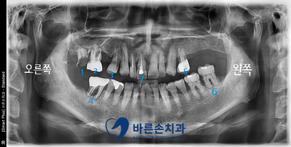 신곡동임플란트