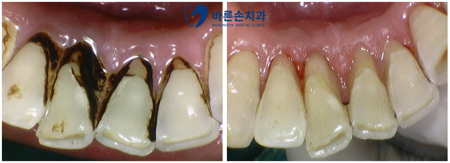 발곡역치과