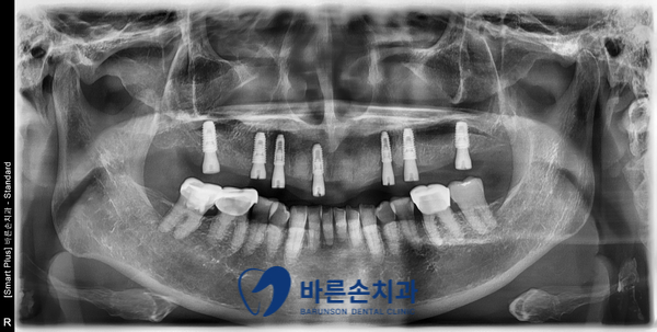 발곡동치과