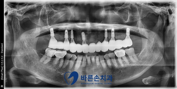 발곡동치과