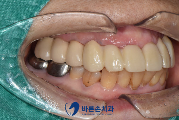 발곡동치과