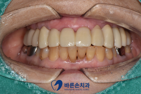 발곡동치과
