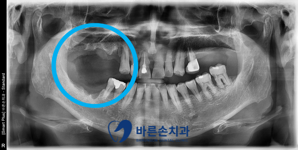 신곡동임플란트