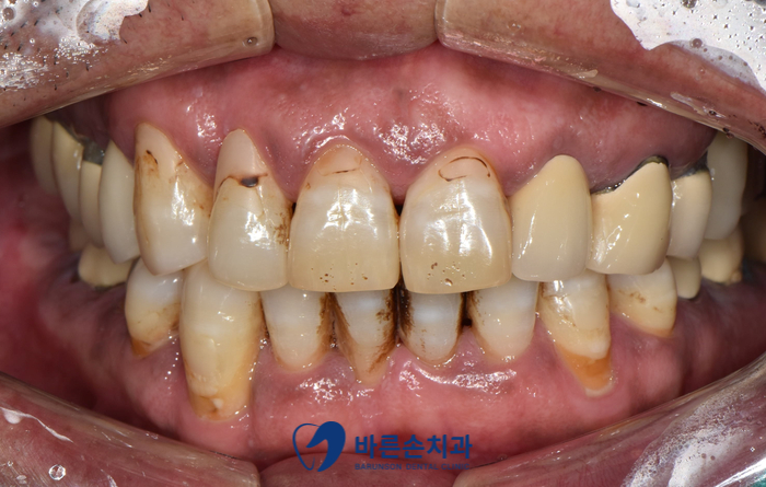 발곡역치과