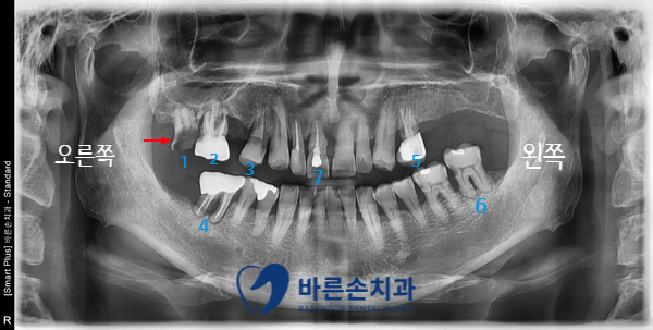 신곡동임플란트