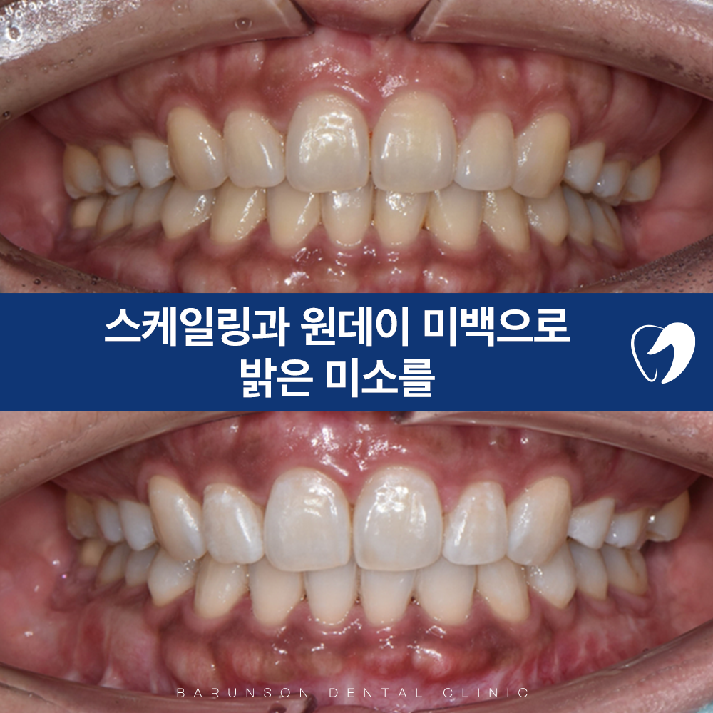 신곡동임플란트