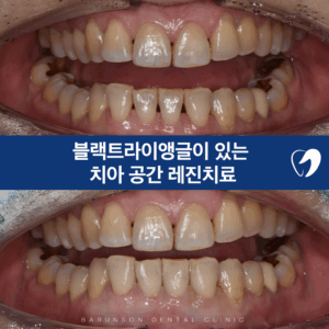 신곡동치과